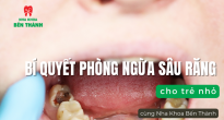 Bí quyết phòng ngừa sâu răng cho trẻ nhỏ cùng Nha Khoa Bến Thành