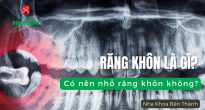 Răng khôn là gì? Có nên nhổ răng khôn không?