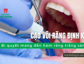 Cạo vôi răng định kỳ tại Nha Khoa Bến Thành: Bí quyết mang đến hàm răng trắng sáng mà không lo về giá