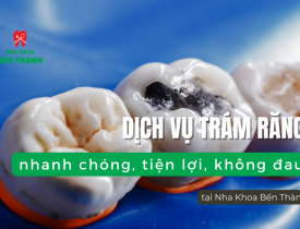 Dịch vụ trám răng nhanh chóng, tiện lợi, không đau tại Nha Khoa Bến Thành
