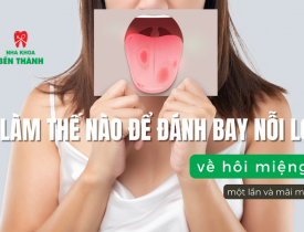Làm thế nào để đánh bay nỗi lo về hôi miệng một lần và mãi mãi