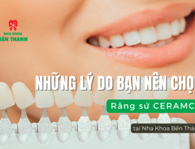 Những lý do bạn nên chọn Răng sứ Ceramco tại Nha Khoa Bến Thành