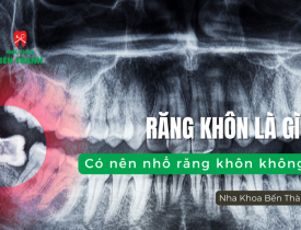 Răng khôn là gì? Có nên nhổ răng khôn không?