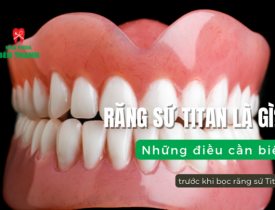 Răng Sứ Titan là gì? Những điều cần biết trước khi bọc răng sứ Titan