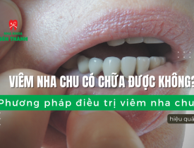 Viêm nha chu có chữa được không? Phương pháp điều trị viêm nha chu hiệu quả