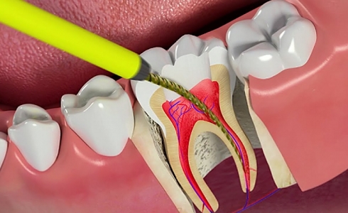 ĐIỀU TRỊ NỘI NHA