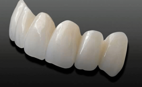 Răng sứ ZIRCONIA