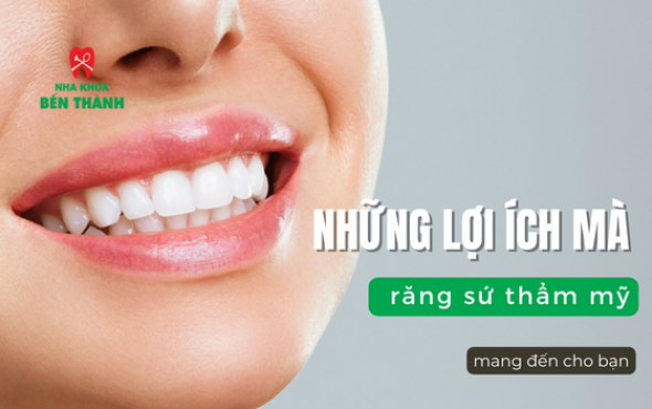 Những lợi ích mà răng sứ thẩm mỹ mang đến cho bạn