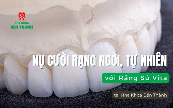 Nụ cười rạng ngời, tự nhiên với Răng Sứ Vita tại Nha Khoa Bến Thành